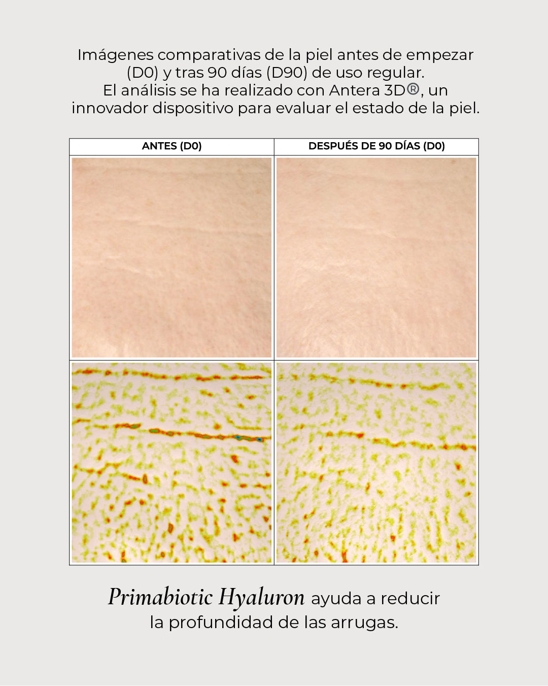 Primabiotic Hyaluron comparativas de la piel antes de empezar y tras 90 dias de uso regular