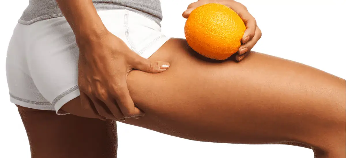 mujer sostiene una naranja en su muslo mostrando piel con celulitis